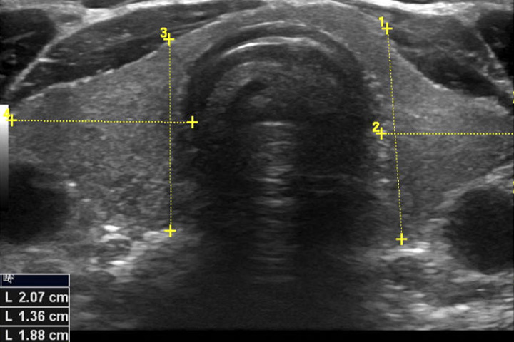 Schilddrüsenultraschall_dr dobnig