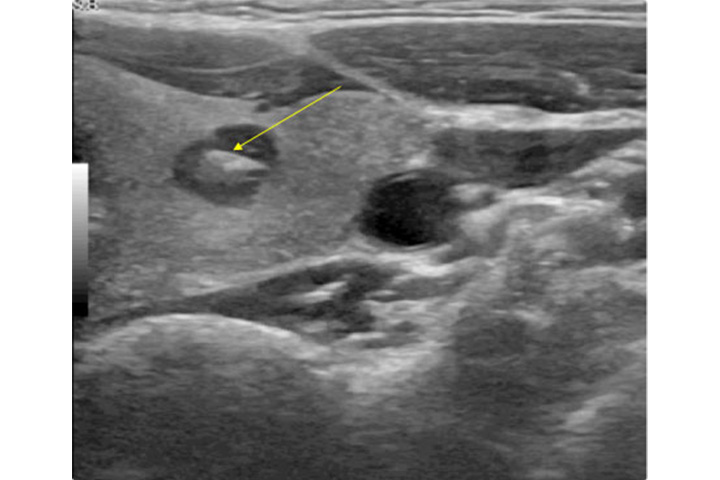 Stanzbiopsie_dr dobnig